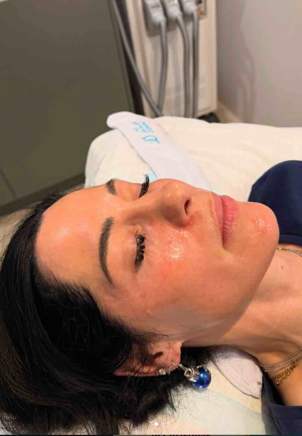 PRX Plus Skin Booster - Reveal Radiant, Youthful Skin – No Needles, No Downtime  The PRX Plus Facial Skin Booster is a revolutionary, non-invasive skin rejuvenation treatment designed to firm, brighten, and revitalise your complexion — all without the discomfort or peeling of traditional chemical peels.